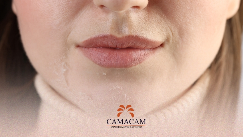 Skincare no Inverno: Como Proteger sua Pele do Ressecamento